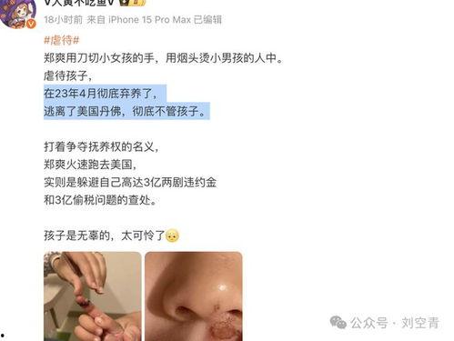 吃瓜爆料免费进最新网站,免费畅游吃瓜爆料最新网站，独家攻略大公开！  第1张